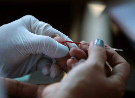 V Česku se od začátku roku žloutenkou A nakazilo nejvíc lidí od revoluce